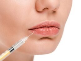 Finding Your Ideal Lip Filler