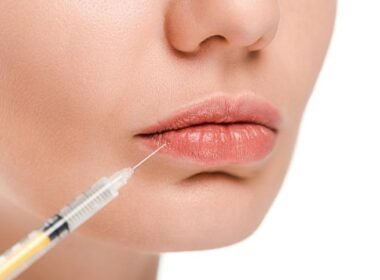 Finding Your Ideal Lip Filler