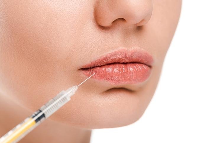 Finding Your Ideal Lip Filler