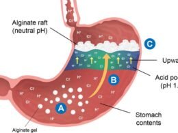 How Alginate Helps Fight Acid Reflux