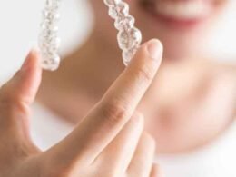 How Alpharetta Orthodontists Customize Clear Aligner Treatment for Every Age Group