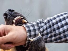 Understanding-Legal-Rights-After-a-Dog-Bite-Incident