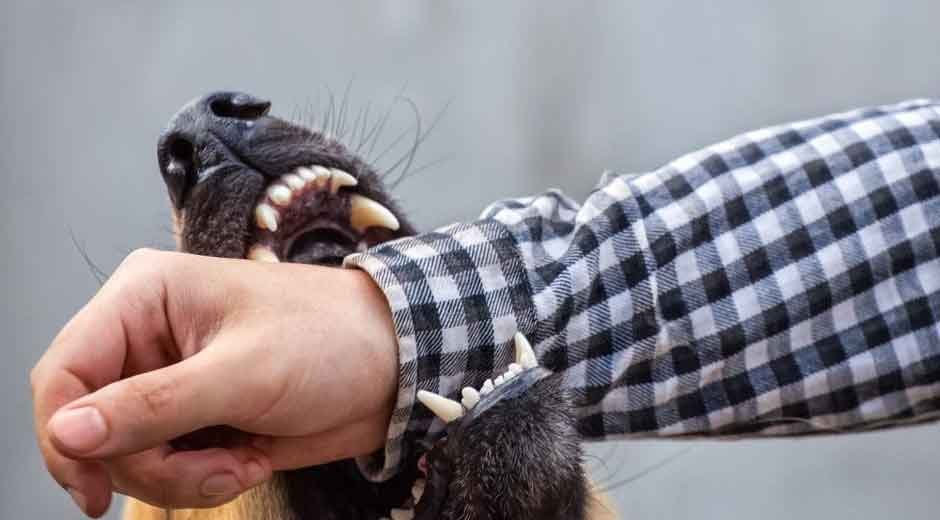 Understanding-Legal-Rights-After-a-Dog-Bite-Incident