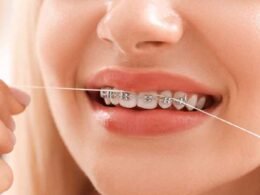 How You Can Benefit from a Virtual Consultation with an Orthodontist in Surrey