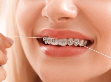 How You Can Benefit from a Virtual Consultation with an Orthodontist in Surrey