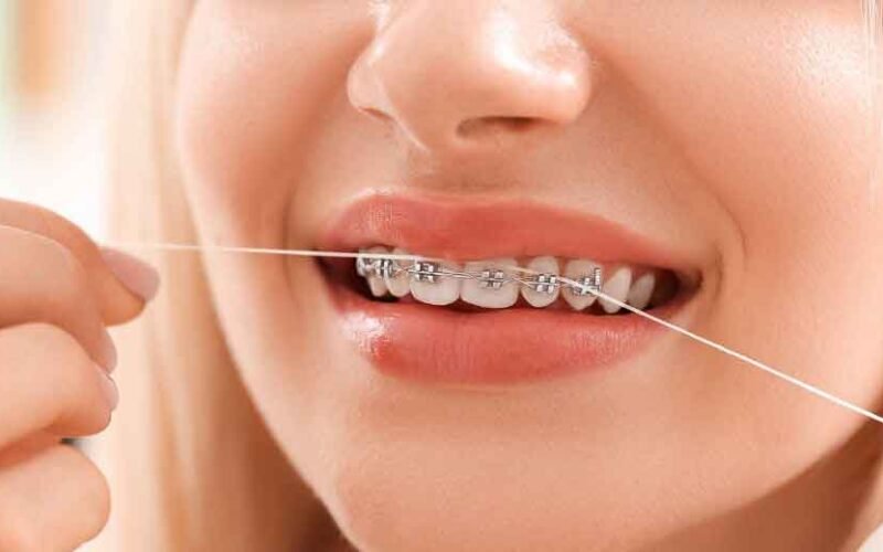 How You Can Benefit from a Virtual Consultation with an Orthodontist in Surrey