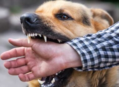 What to Do After a Dog Bite in Kansas City: A Legal Guide